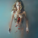 Therapy, Limited Edition Print